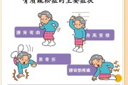 骨质疏松离你有多近？这些症状和风险人群要警惕