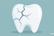 牙齿磕出裂纹没掉色？小心神经已坏死