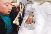 被人咬伤出血怎么办？别大意，可能会截指