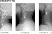 颈椎病选枕头，记住这3点：高度、软硬、材质