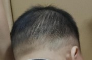 宝宝头发稀少别瞎补钙，多半是正常换毛或磨秃的