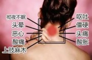 脖子酸痛？选对枕头很重要，颈椎病适合的枕头有讲究