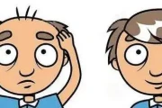 植发三天速成？看效果图前先避坑