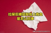 擦屁股纸上有血咋回事？自己检查小心弄出血