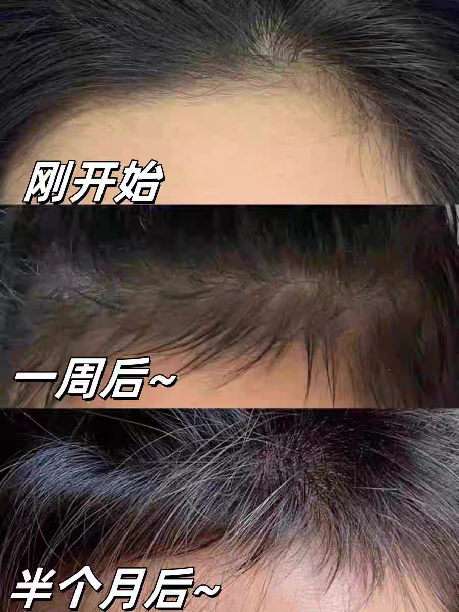 男生防脱控油洗发水_如格防脱草本植萃洗发水_脸胖发际线高男士发型