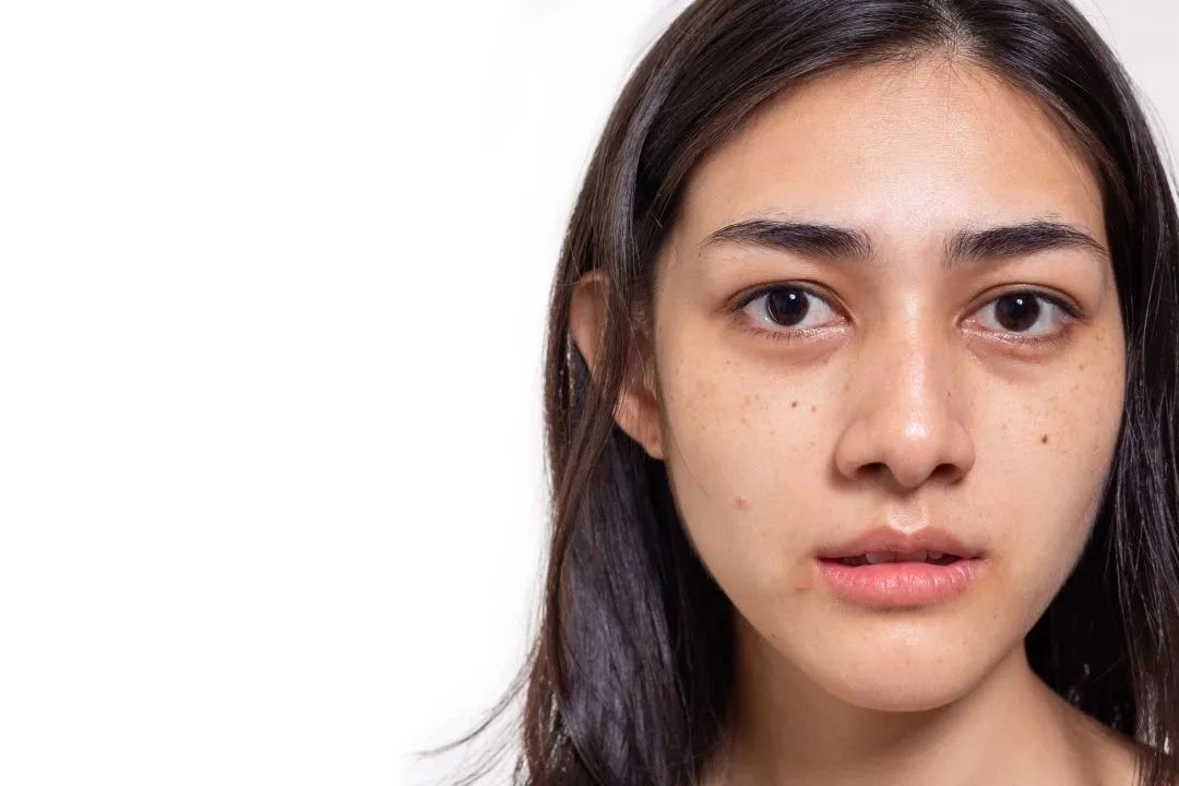 熬夜对身体伤害_长期喝黑枸杞皮肤好得不得了_熬夜如何降低伤害
