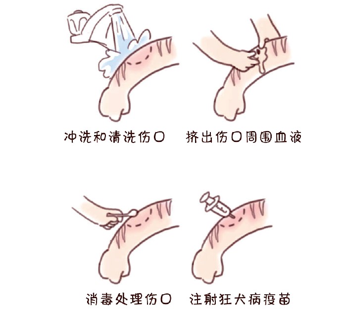 让狗咬了出血了怎么办_狂犬病疫苗注射指南_被猫抓伤处理流程