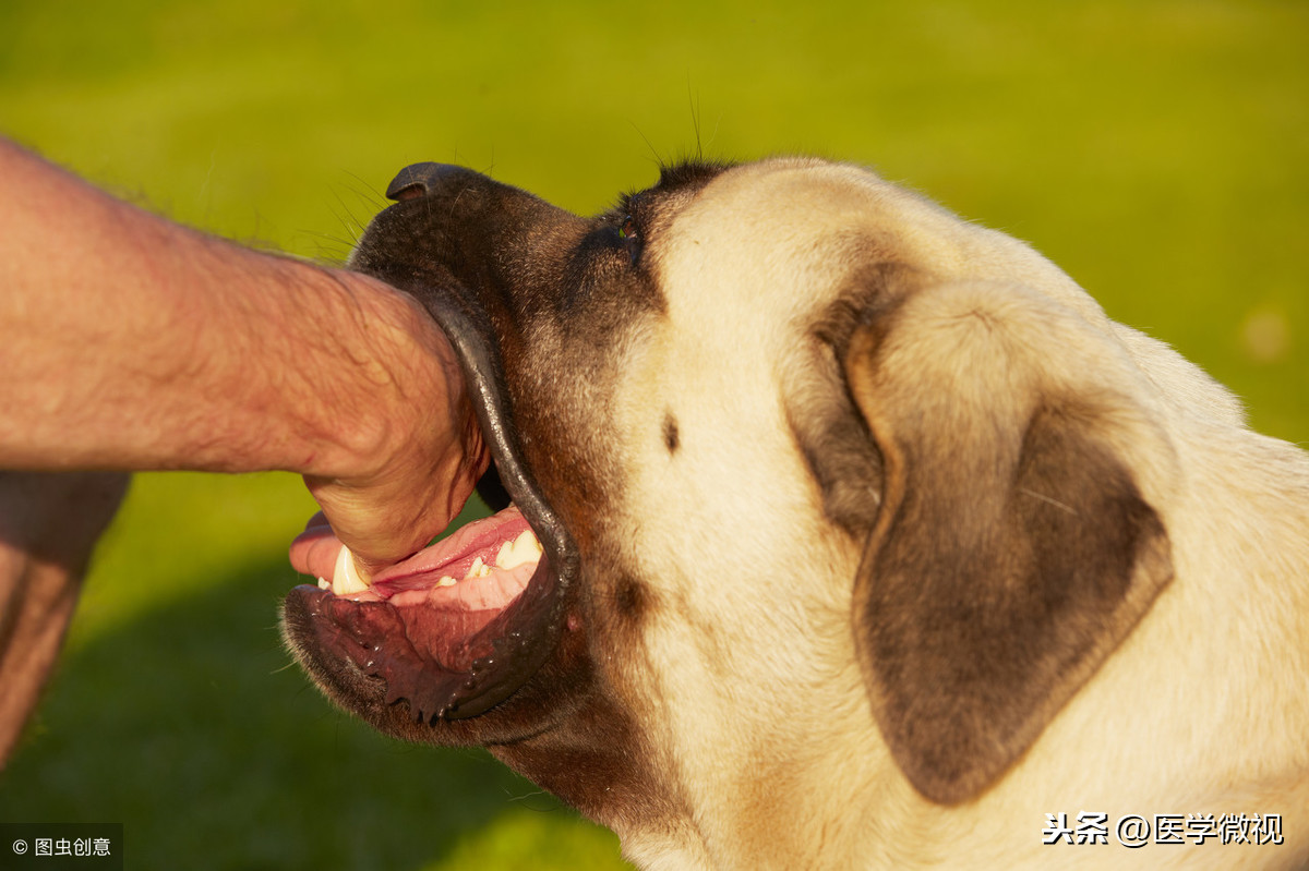 让狗咬了出血了怎么办_狂犬病暴露分级处理_狂犬病暴露后疫苗注射指南