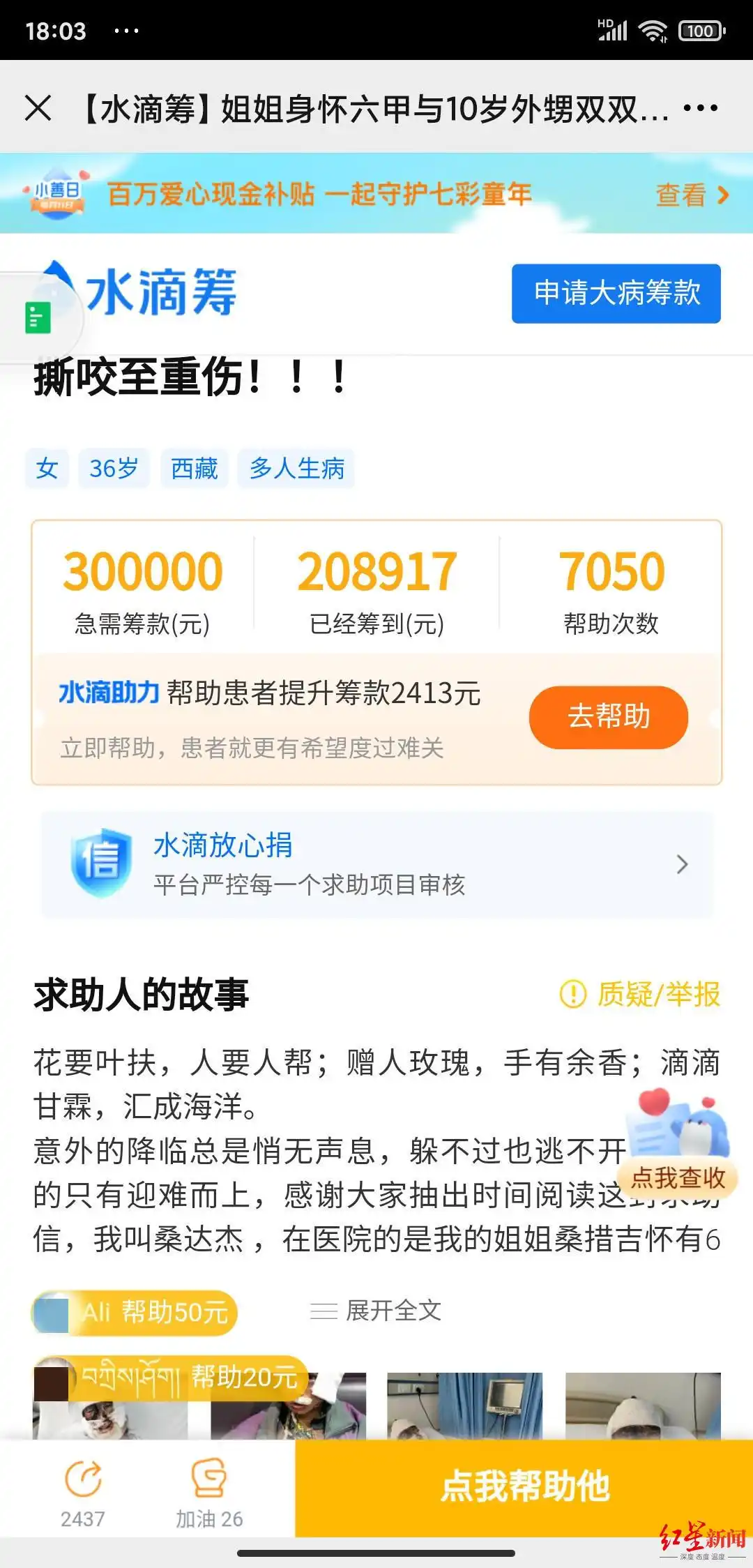 棕熊伤人事件_西藏丁青县熊吃人事件系谣言_四川省人民医院虫草伤者筹款