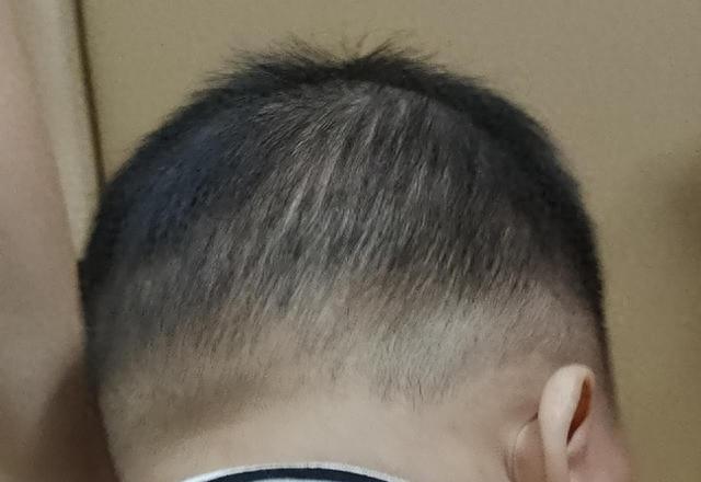 宝宝头发稀疏_宝宝头发稀少是缺什么_宝宝枕秃原因