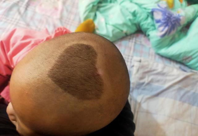宝宝头发稀疏_宝宝枕秃原因_宝宝头发稀少是缺什么