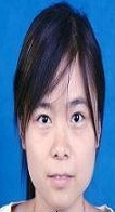 过度洗头危害_头皮屏障破坏_头发洗太勤有什么危害