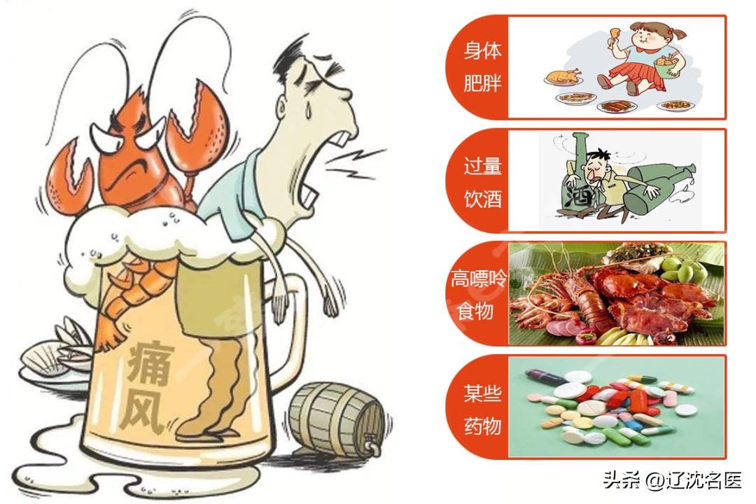 肥胖导致痛风 高尿酸血症 痛风患者戒酒_高尿酸血症的退伍军人