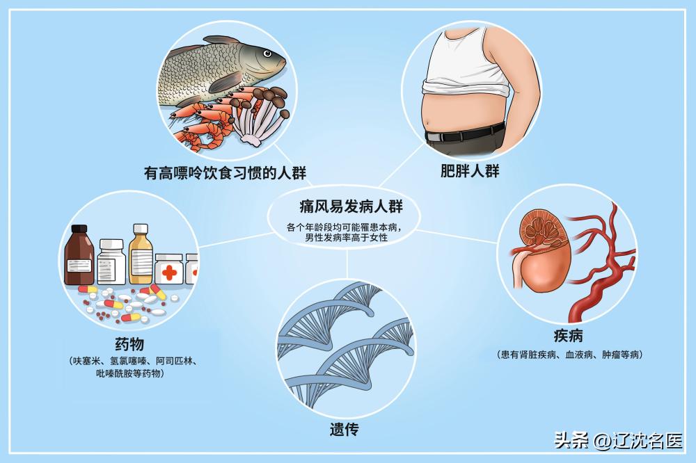 肥胖导致痛风 高尿酸血症 痛风患者戒酒_高尿酸血症的退伍军人