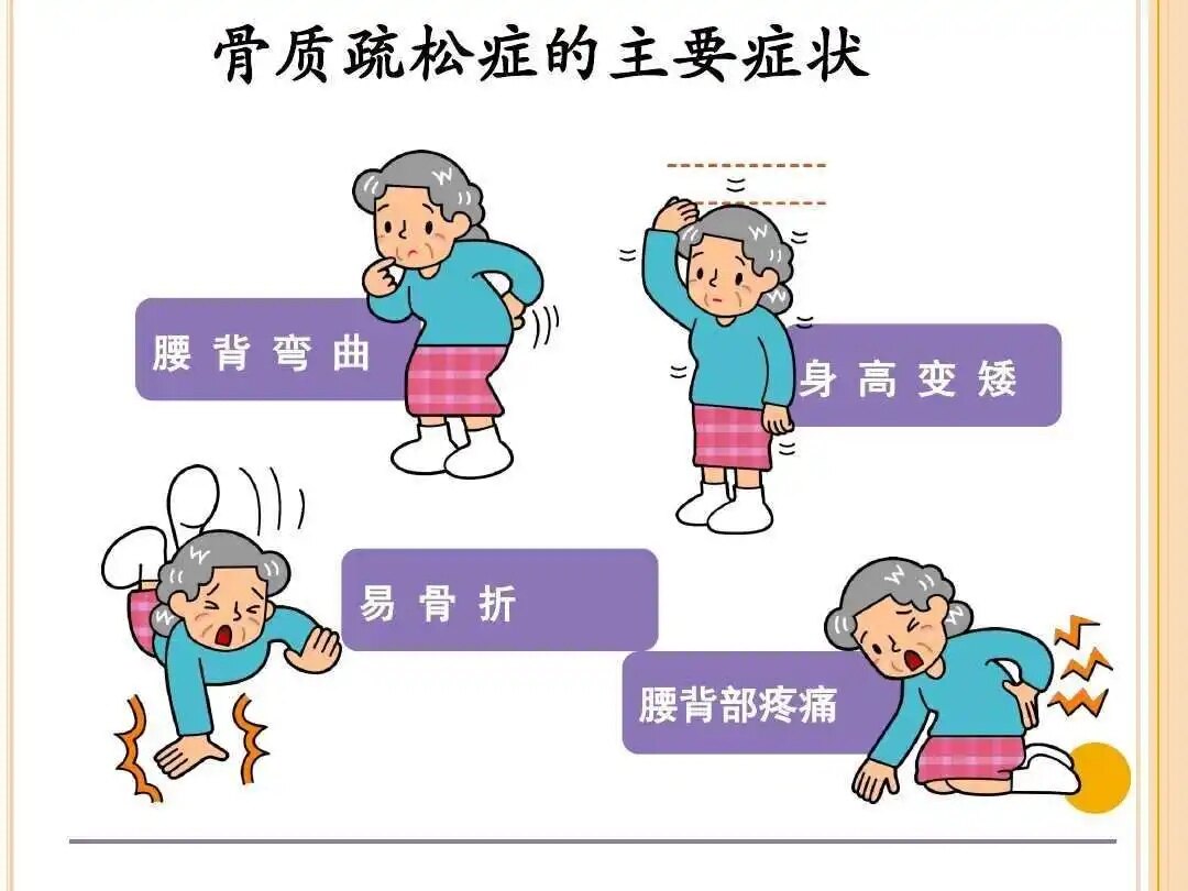乳腺癌患者骨质疏松_骨质疏松的相关知识_骨质疏松症状