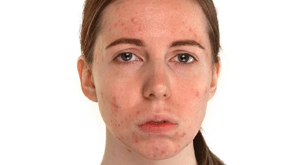 海鲜有寄生虫为什么能补丐呢_药物补钙选择_补钙食物推荐