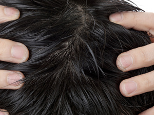 最先进防脱发药有哪些药