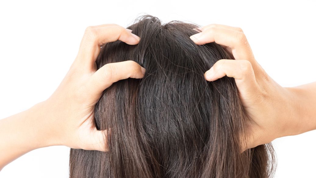 桑叶疏风润燥养毛窍_头皮干痒脱屑脱发_有什么办法能让头发长快点