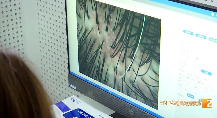 警惕虚假营销 安全使用染发膏_劣质染发剂对人体健康损害_买染发剂需要注意什么