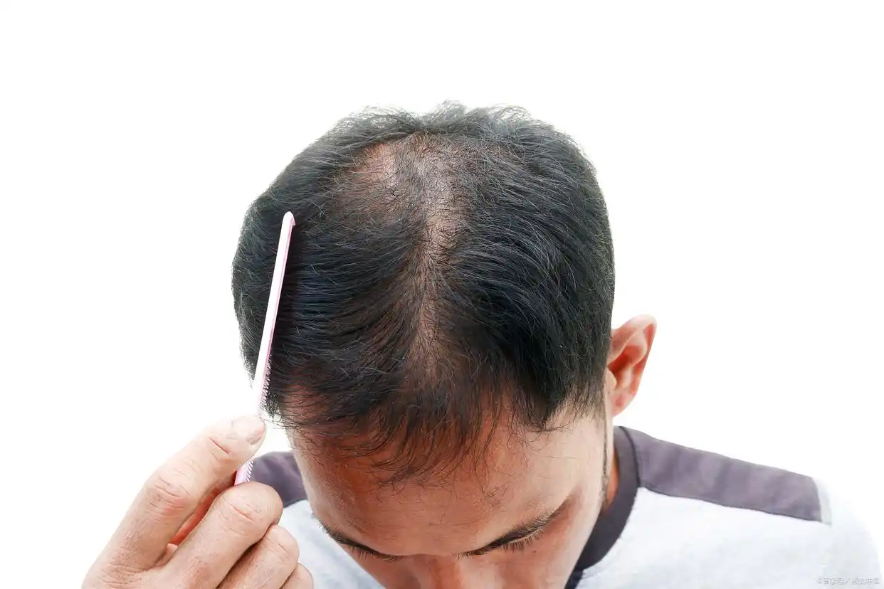 防脱发最好的产品_露卡菲娅防脱精华液测评_防脱育发产品推荐