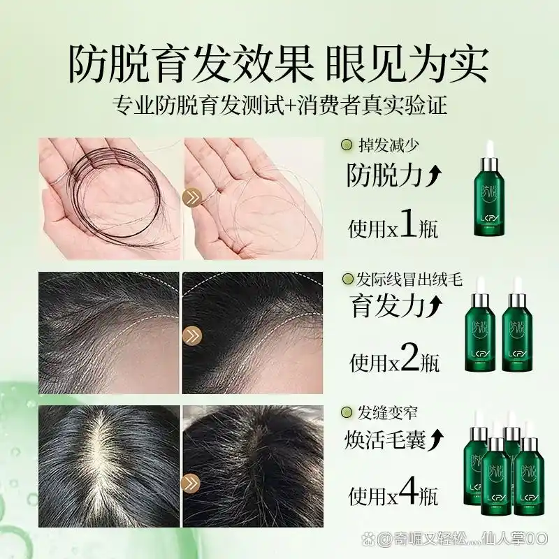 防脱发最好的产品_露卡菲娅防脱精华液测评_防脱育发产品推荐