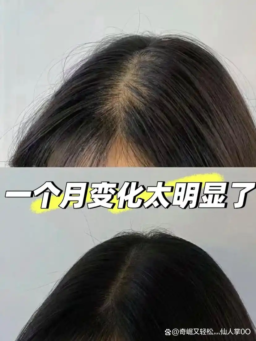 防脱育发产品推荐_露卡菲娅防脱精华液测评_防脱发最好的产品