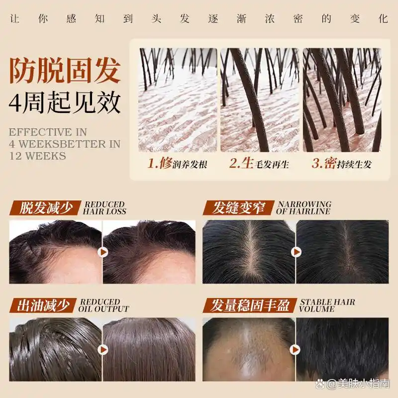 OHBT何首乌防脱生发洗发水套装_防脱发最好的产品_十大公认最好的防脱洗发水品牌