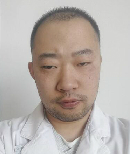 被家猫抓伤轻微出血猫没事_被猫抓伤出血打狂犬疫苗_猫抓伤出血需要打狂犬疫苗吗