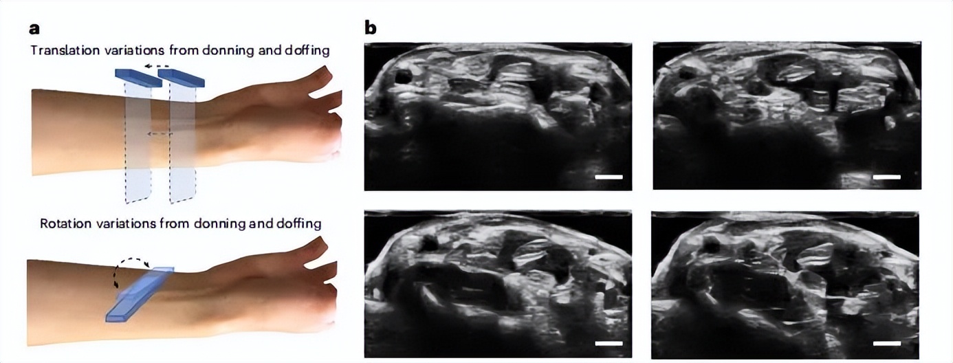 中兴手环×2app_可穿戴超声手环_MIT超声手环
