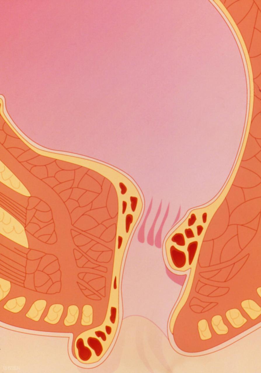 自己弄弄肛门看里面弄出点血_痔疮出血颜色_痔疮出血特点