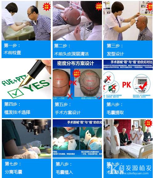 春季植发_植发最佳季节_肾虚会影响植发效果吗
