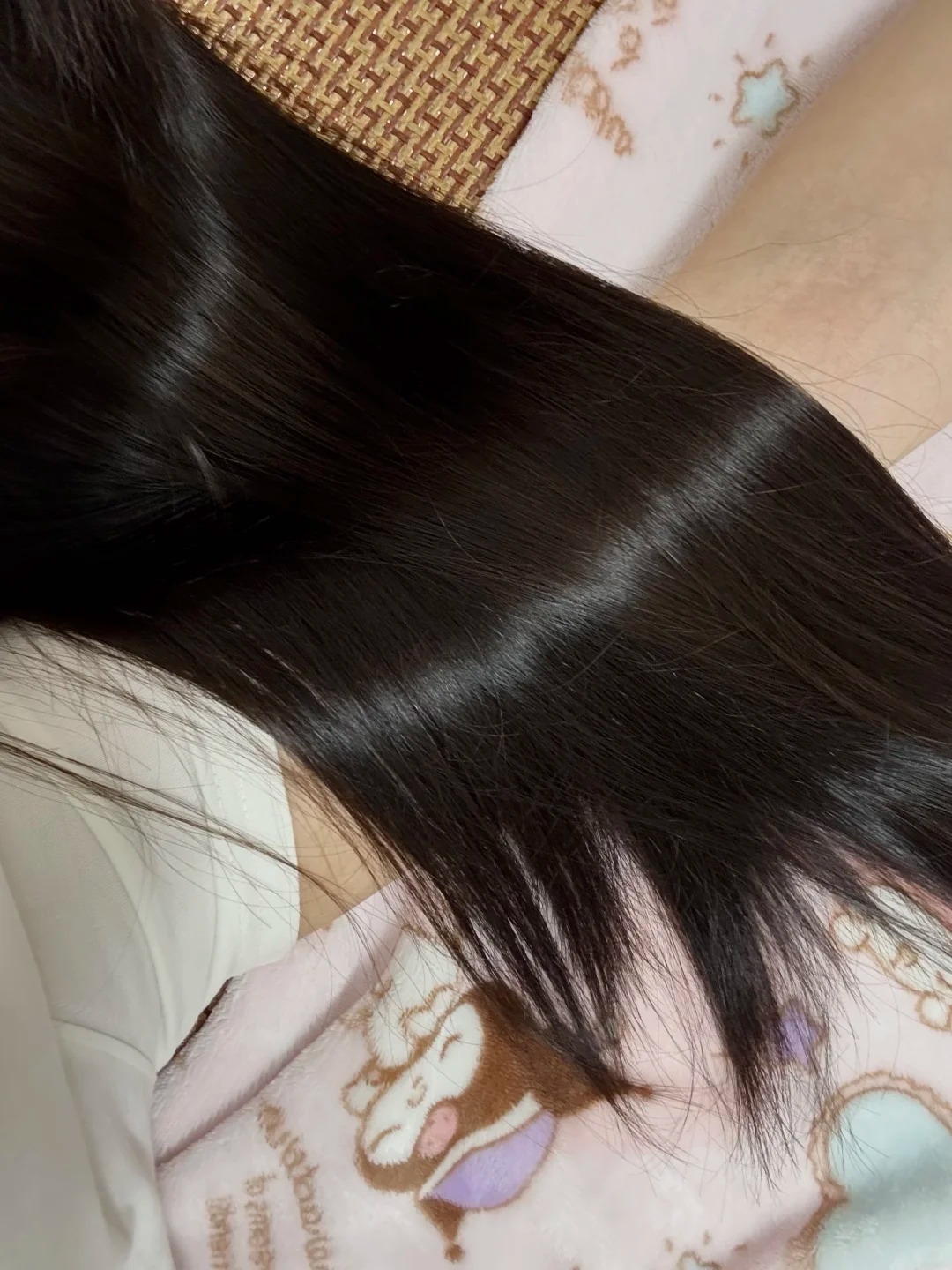 医生推荐8招养发妙招_肾虚会影响植发效果吗_冬季掉发多脂溢性脱发调理