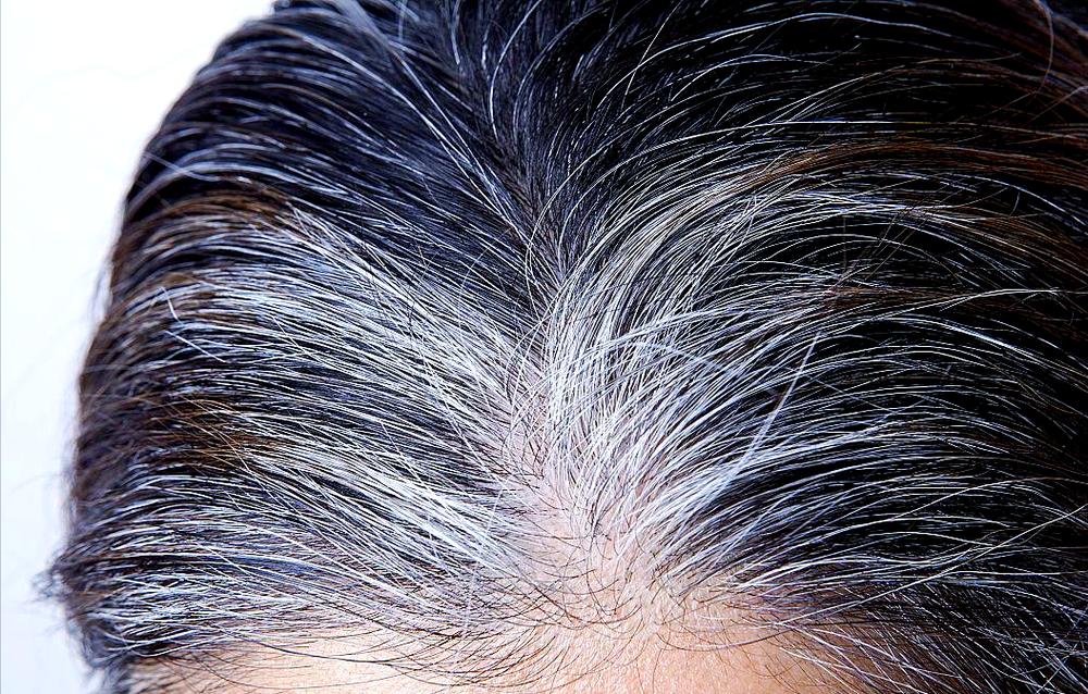 长期喝黑枸杞皮肤好得不得了_黑枸杞补肾护眼功效_冬季养肾黑枸杞好处