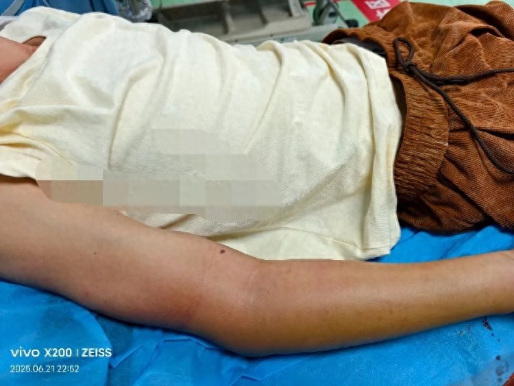 重庆五步蛇咬伤急救_重庆常见毒蛇种类及防治_云南有没有眼镜蛇血清