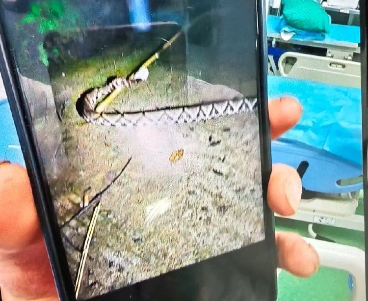 云南有没有眼镜蛇血清_重庆常见毒蛇种类及防治_重庆五步蛇咬伤急救