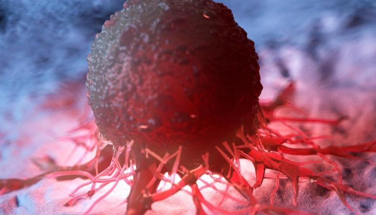 牙龈溃疡不愈癌症征兆_牙齿变色神经死了没有_牙齿松动牙龈出血癌症信号