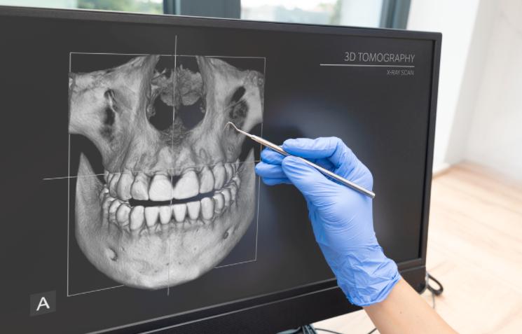 牙齿变色神经死了没有_牙龈溃疡不愈癌症征兆_牙齿松动牙龈出血癌症信号