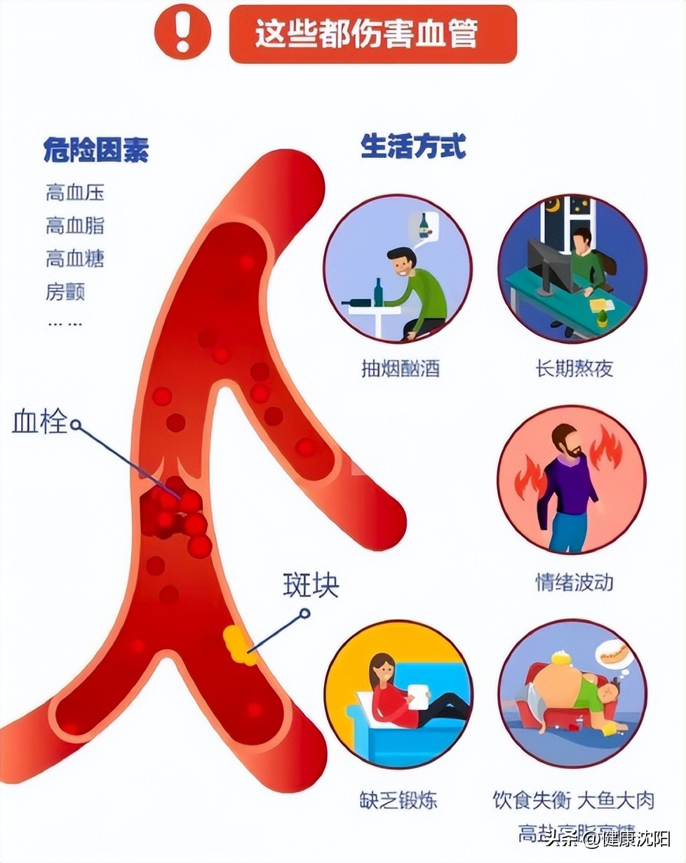 血管年轻的重要性_血管年轻的表现_毛细血管静水压公式