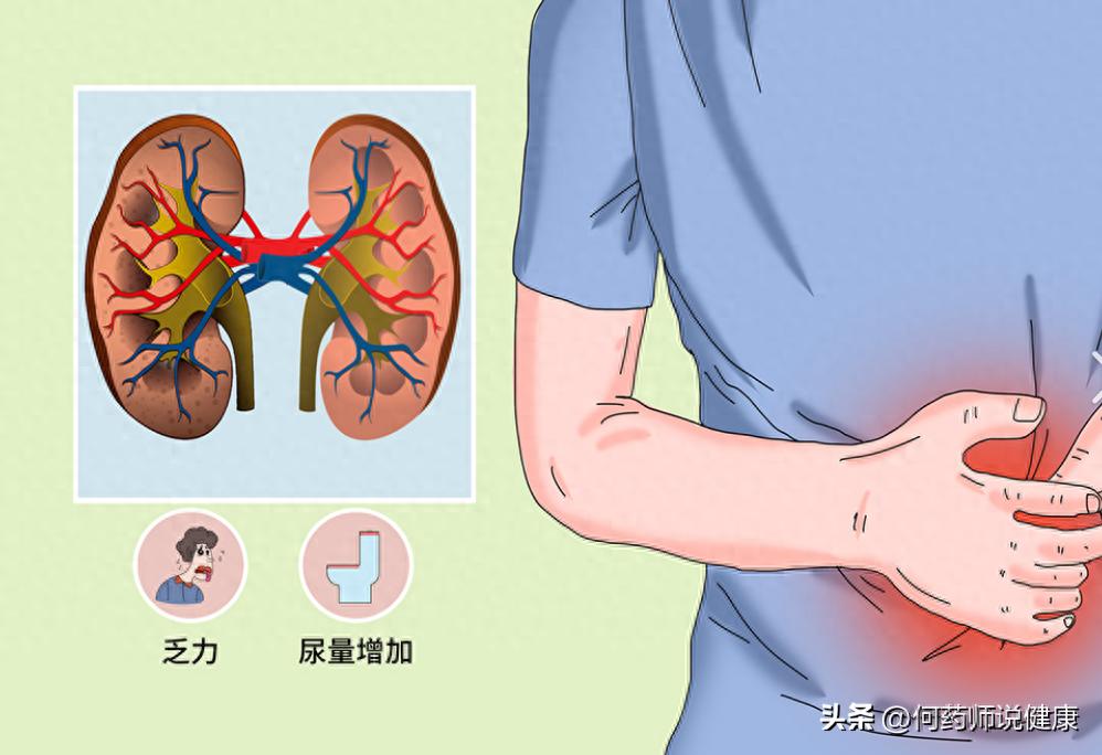 慢性肾衰竭早期症状_肾小球硬化多少会肾衰_乏力食欲不振水肿夜尿增多高血压