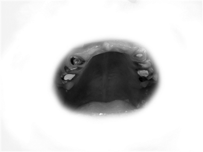 只喝饮料不喝水 牙齿烂成什么样 功能饮料当水喝伤身体_一天不吃饭光喝水会死吗