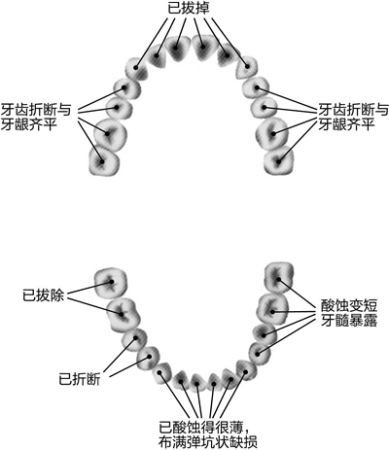 一天不吃饭光喝水会死吗_只喝饮料不喝水 牙齿烂成什么样 功能饮料当水喝伤身体