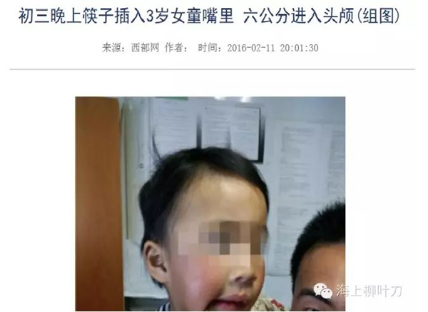 宝宝筷子插入头部手术_上海新华医院异物取出_小孩玩筷子扎伤上口腔