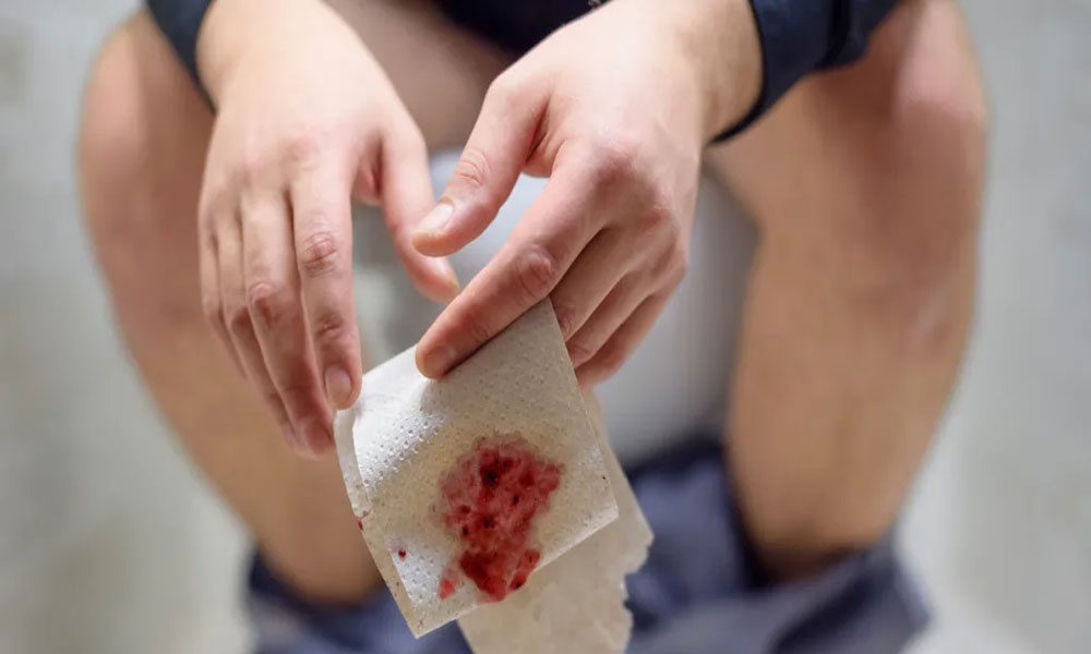 阴道炎预防与治疗_女性私处湿巾使用方法_酒店女士湿巾有什么作用