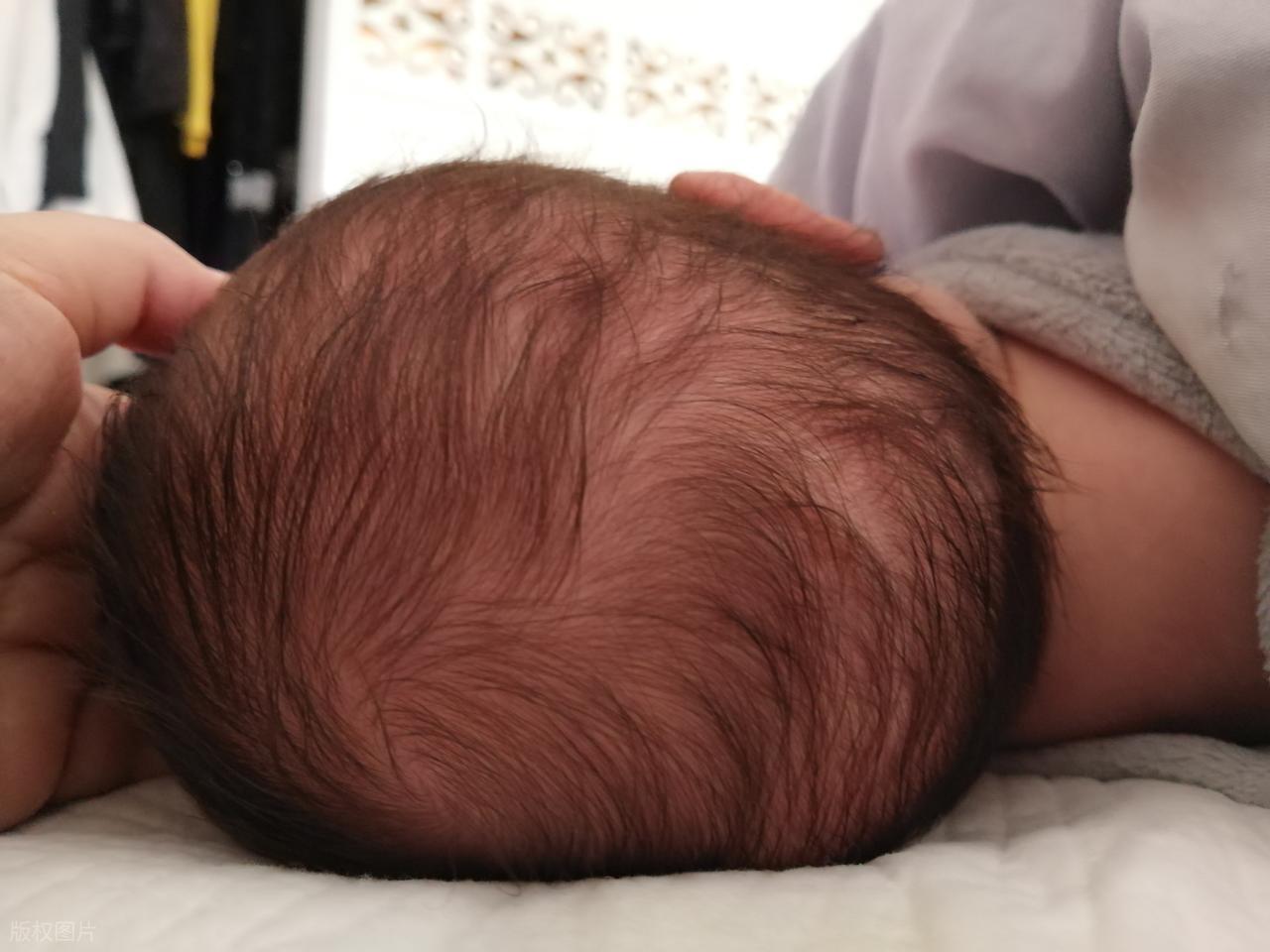 宝宝头发不均匀原因_宝宝睡觉头会出很多汗为什么_宝宝头发稀疏护理