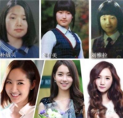 韩国明星整容_韩国整容失败女星_整形手术明星案例