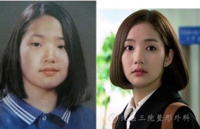 韩国整容失败女星_整形手术明星案例_韩国明星整容