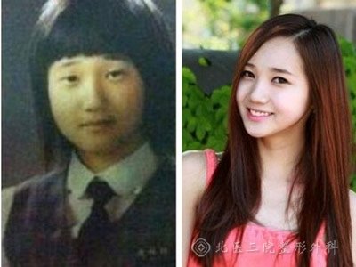 韩国明星整容_韩国整容失败女星_整形手术明星案例