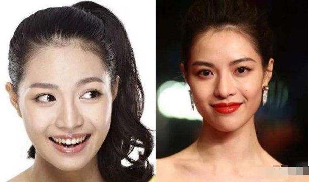 韩国整容失败女星_天然美女与整形_中国娱乐圈整容女明星