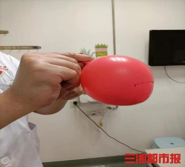 显微镜下缝合气球_国外医生用气球给鼻塞患者通气_神经外科缝合技术