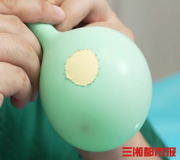显微镜下缝合气球_国外医生用气球给鼻塞患者通气_神经外科缝合技术